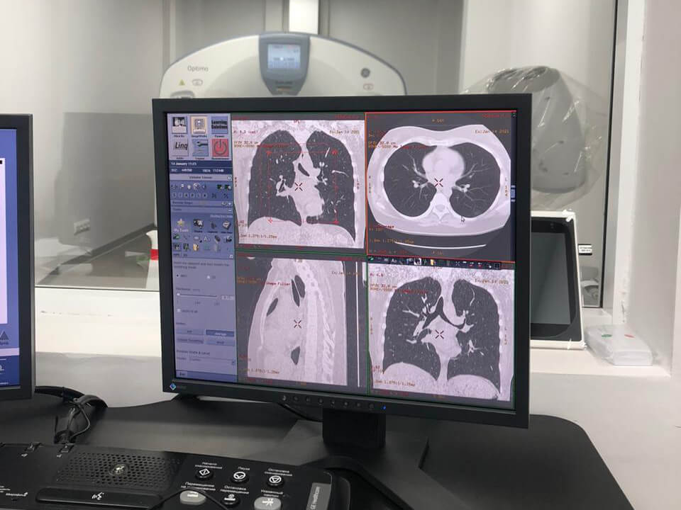 Компьютерная томография в Клинике КОНСТАНТА
